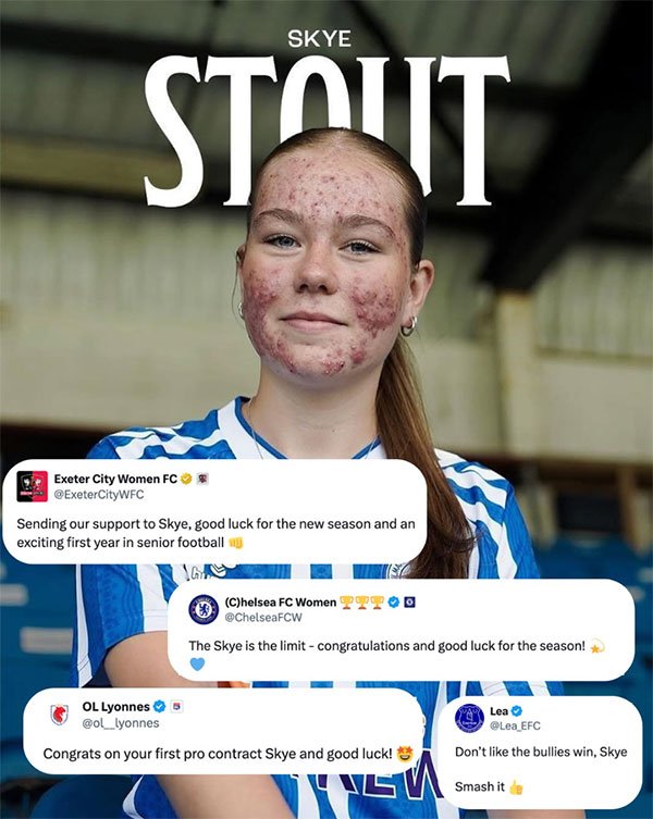 Skye Stout’s Goal: A Win Against Cruelty Beyond Football