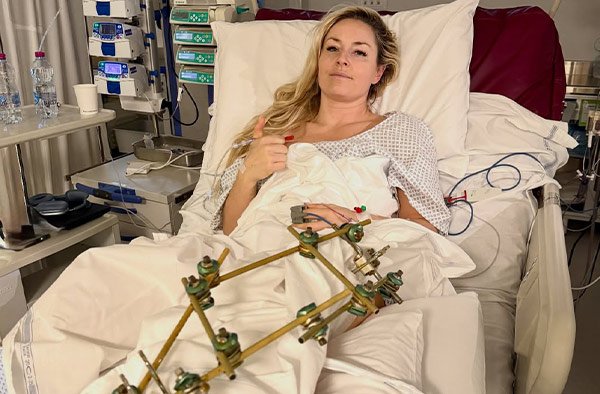 Lindsey Vonn Undergoes Third Surgery After Crash at Milan Cortina Olympics