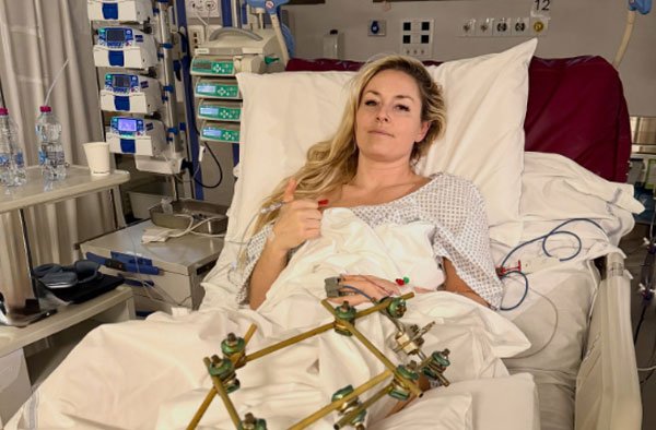 Lindsey Vonn Reveals Compartment Syndrome After Shocking Crash at 2026 Milan-Cortina Olympics